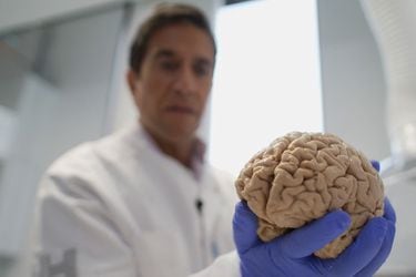 La escalofriante colección de 10.000 cerebros que tiene Dinamarca