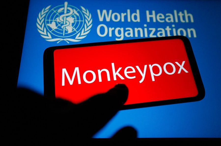 Lee también en Qué Pasa: Se estiman 25 casos positivos de viruela del mono en Nueva York