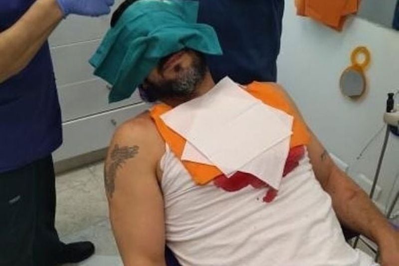 La imagen muestra a Rafael Cavada ensangrentado y siendo atendido