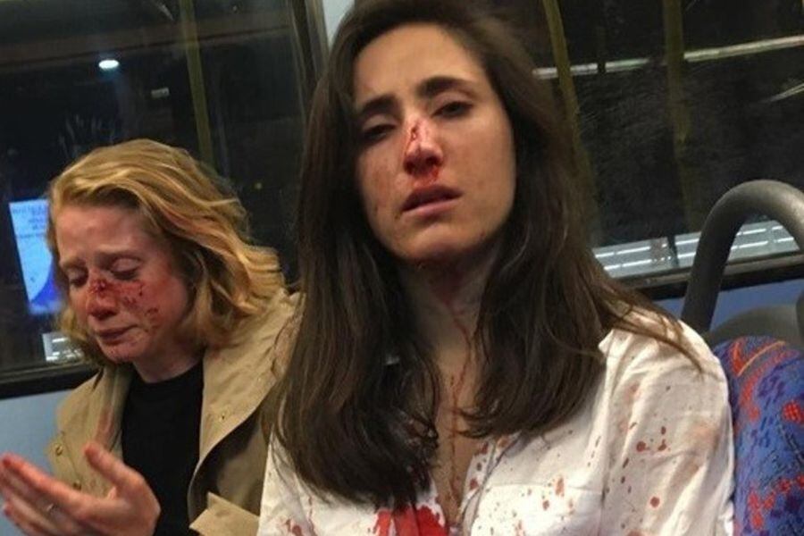 Detenidos por agresión a pareja lesbiana en Londres son liberados bajo fianza - La Tercera Detenidos por agresión a pareja lesbiana en Londres son liberados bajo fianza - La Tercera