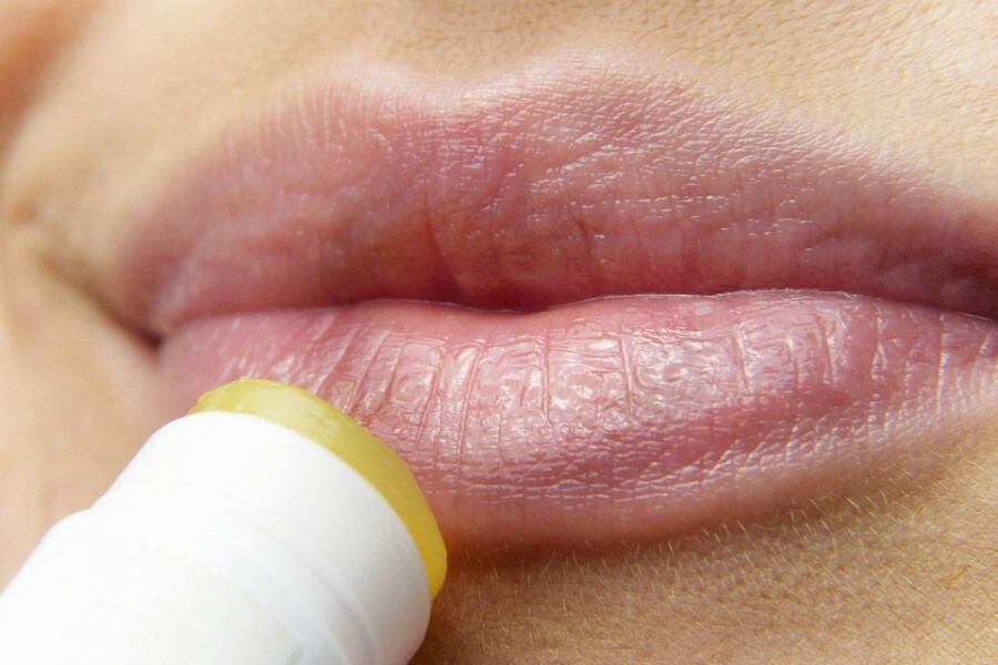 labios herpes