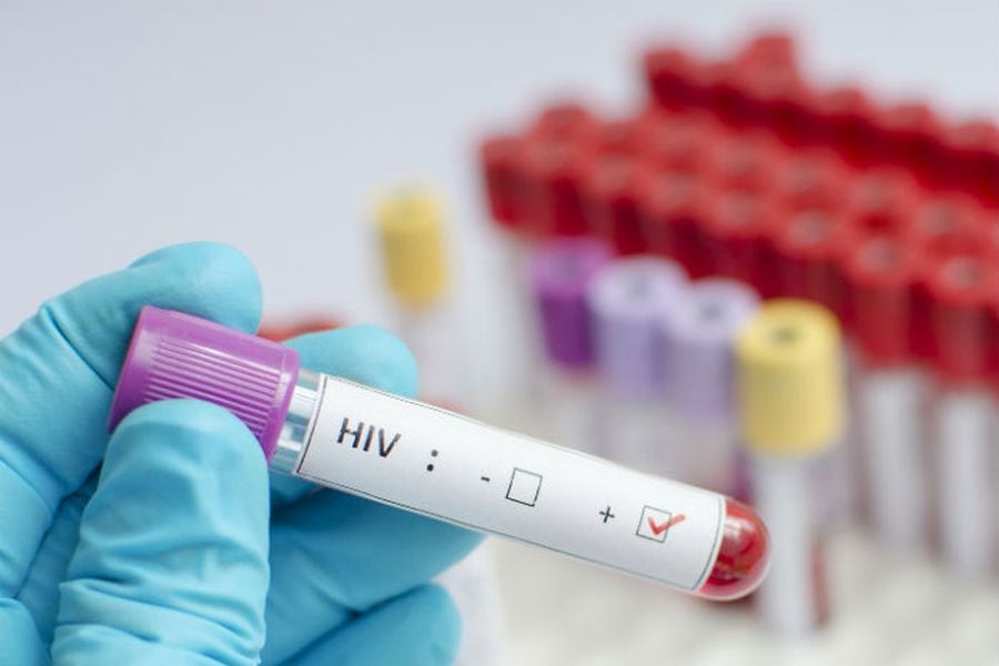CIENTÍFICOS ESTADOUNIDENSES LOGRAN CURAR A MUJER CON VIH 