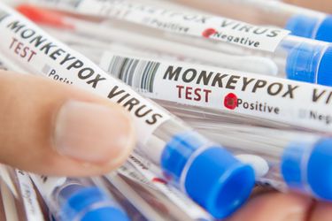 Viruela del mono ya tiene estatus de pandemia: ¿Cómo se contagia? ¿Hay vacuna? 