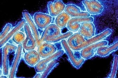 Fact Checking: ¿Ómicron BA.5 es más infeccioso que el sarampión y el más contagioso que se conozca? ¿El nuevo brote del virus de Marburgo comenzó en 2021?