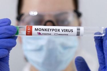 Estados Unidos planea declarar emergencia sanitaria por brote de viruela del mono