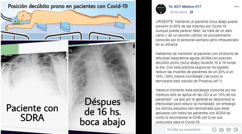 la imagen muestra cómo mejora el paciente de acuerdo a la nueva posición