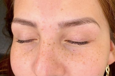 Freckling: la tendencia que crea pecas con micropigmentación