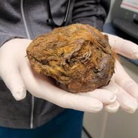Descubren momia de 30 mil años más extraña que se haya visto: con rayos X pudieron dar con su origen