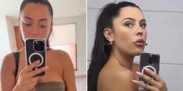 Daniela Aránguiz muestra moretón en un video