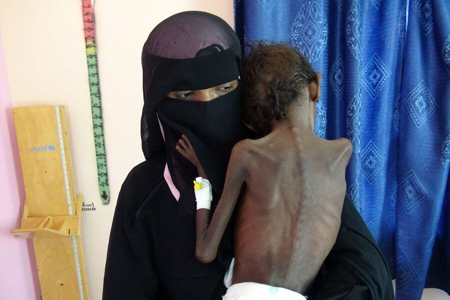 hambruna en yemen