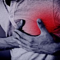 ¿Cuál es la diferencia entre ataque al corazón y paro cardíaco? Esto es lo que hay que hacer en cada caso