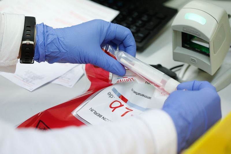 Samples are prepared for tests for the corona virus at a laboratory in Berlin, Germany, March 26, 2020, as the spread of the coronavirus disease (COVID-19) continues. REUTERS/Axel Schmidt