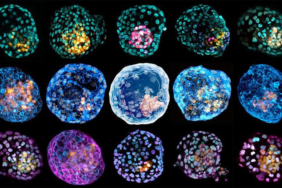 Científicos crean modelo artificial de embrión humano a partir de células  de la piel - La Tercera