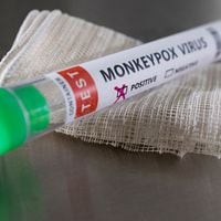 Viruela del mono: ¿en qué consiste la alerta sanitaria decretada por el Minsal?