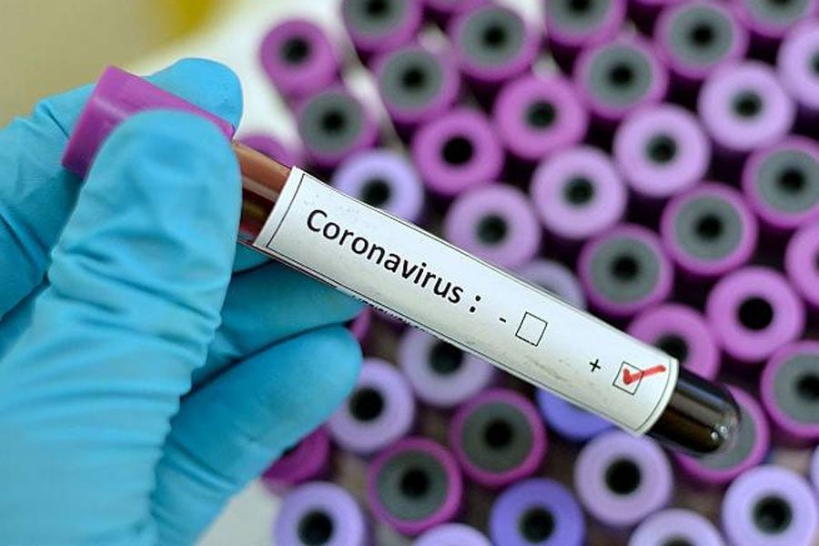 examen coronavirus