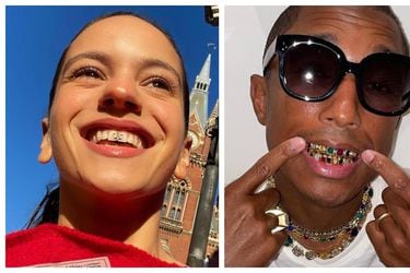 A lo Rosalía y Pharrell Williams: estos son los riesgos de tener joyas en los dientes  