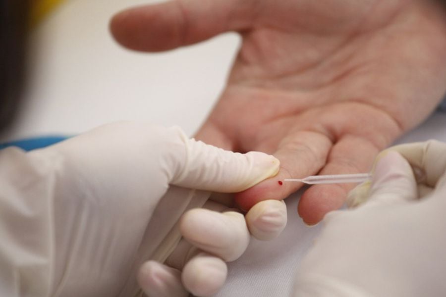 Toma de muestras gratuitas para detectar presencia de Hepatitis C