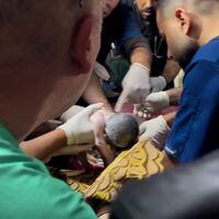 La historia de la bebé prematura que fue rescatada del vientre de su madre tras un ataque israelí