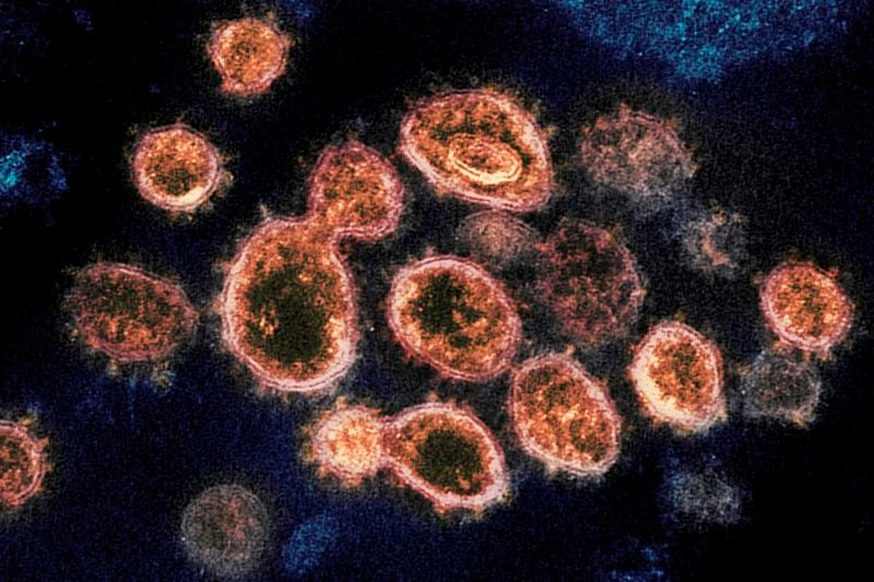 Esto pasaría en Chile tras llegada de variante Delta, estos son sus principales  síntomas y cepa tiene una versión “plus” que sería más peligrosa: tres  cosas que aprendimos del coronavirus esta semana -