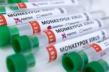 OMS cree que viruela del mono podría transformarse en una enfermedad de transmisión sexual