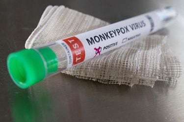 Japón confirma el primer caso de viruela del mono en el país