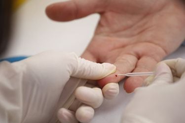 Toma de muestras gratuitas para detectar presencia de Hepatitis C