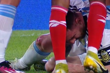 De amistoso muy poco: la dura entrada que dejó sangrando a Lionel Messi en el duelo entre Argentina y Panamá