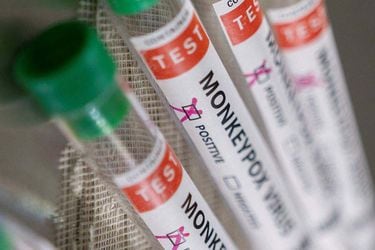 EE.UU. reserva más vacunas de viruela del mono para distribuir en eventos del orgullo gay
