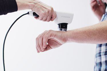 Microscopio Confocal en UC CHRISTUS: Tecnología avanzada para la detección de cáncer de piel