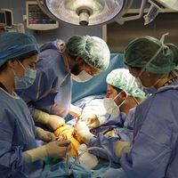 Listas de espera quirúrgicas batieron récords en 2023 en la salud pública de España 
