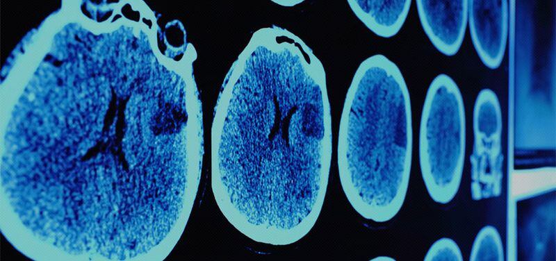 rodar Prevención Sabueso El microondas produce cáncer?: Oncólogos se unen contra las "noticias falsas" - La Tercera rodar Prevención Sabueso El microondas produce cáncer?: Oncólogos se unen contra las "noticias falsas" - La Tercera