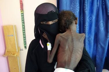 hambruna en yemen