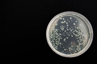 bacteria-359956_1280