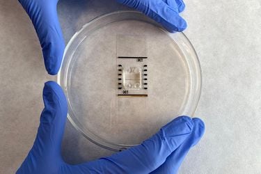 Con nanopartículas de oro: científicas crean tecnología para probar fármacos contra el alzhéimer