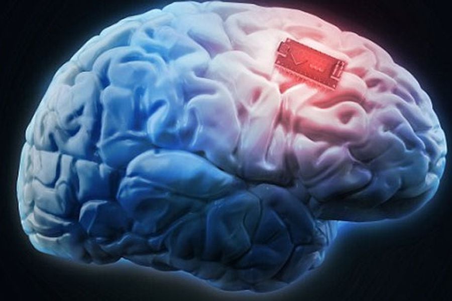 brain