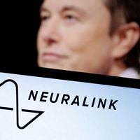 La FDA encuentra problemas en el laboratorio de animales dirigido por la empresa de implantes cerebrales de Musk