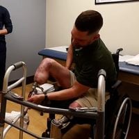 Hombre que sufrió la amputación de sus piernas vuelve a caminar gracias a una revolucionaria cirugía