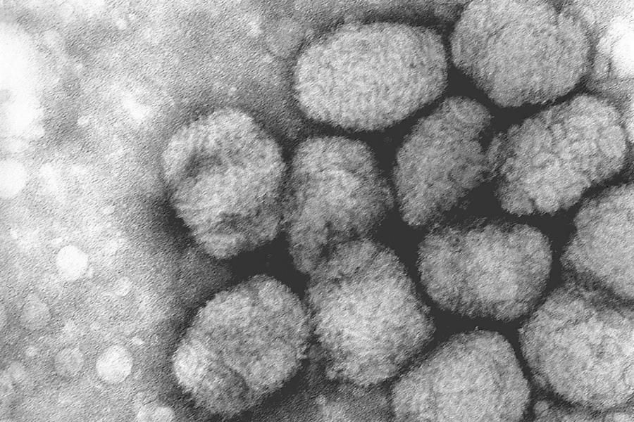 Transmission electron micrograph of smallpox viruses