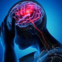 Qué es un ACV y cuál es el pronóstico tras un accidente cerebrovascular