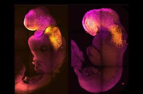 Científicos de Cambridge crean embriones sintéticos con cerebro y corazón latiendo