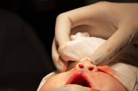 En pionero estudio publicado en Nature, científico chileno descubre cómo se produce el labio leporino