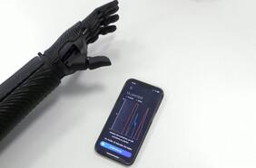 Desarrollan el primer brazo biónico del mundo impreso en 3D