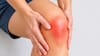 La terapia para la osteoartritis de rodilla donde el 80% reportó un alivio de dolor significativo sin cirugía