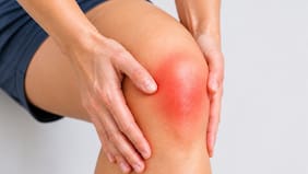 La terapia para la osteoartritis de rodilla donde el 80% reportó un alivio de dolor significativo sin cirugía