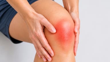 La terapia para la osteoartritis de rodilla donde el 80% reportó un alivio de dolor significativo sin cirugía