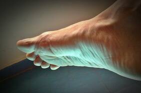 ¿Qué tan peligroso son los pies planos? Esto concluyó un nuevo estudio