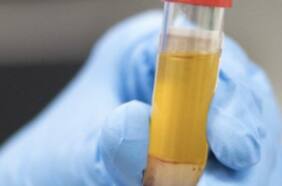 Estudio más completo hasta ahora: terapia con plasma es segura y aumenta posibilidad de sobrevivir al coronavirus