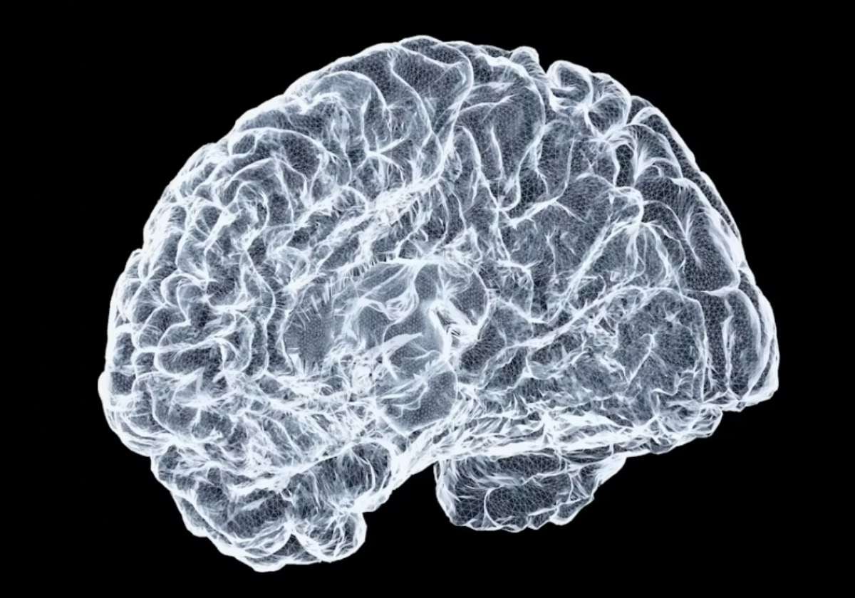 Estos son los trastornos que están relacionados con un envejecimiento cerebral más rápido, según un estudio
