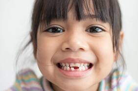 Las deudas de Chile con la salud dental de sus niños