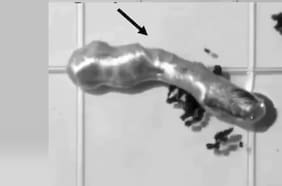 Crean un ejército de microrobots capaces limpiar arterias bloqueadas